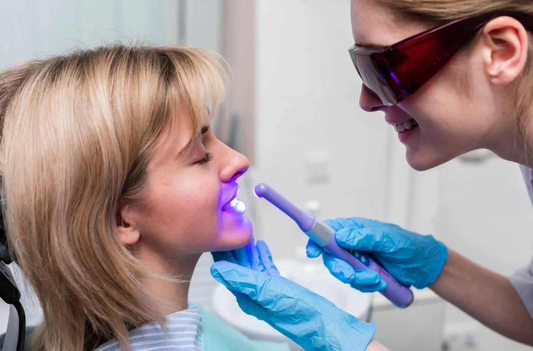 como funciona o clareamento dental caseiro